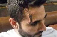 أحمد عز يتعرض لإصابة في رأسه