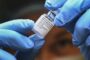 تعقب 200 شخص في 27 ولاية أمريكية بحثا عن فيروس جدري القرود