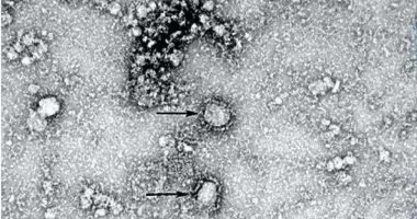 أمريكا: رصد متحور جديد لفيروس كورونا في 3 ولايات